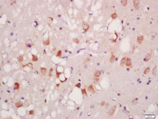 Phospho-ATG1 (Ser556) Antibody in Immunohistochemistry (Paraffin) (IHC (P))