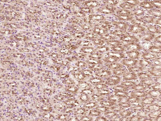 Phospho-YB1 (Ser102) Antibody in Immunohistochemistry (Paraffin) (IHC (P))