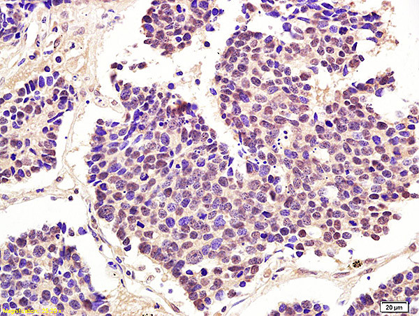 Phospho-cdc2 (Thr161) Antibody in Immunohistochemistry (Paraffin) (IHC (P))