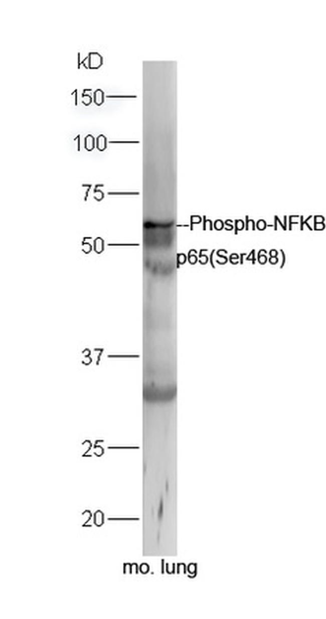 Phospho-NFKB p65 (Ser468) Antibody in Western Blot (WB)