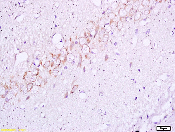 Phospho-Insulin Receptor Beta (Tyr1355) Antibody in Immunohistochemistry (Paraffin) (IHC (P))