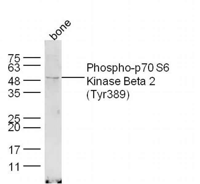 Phospho-p70 S6 Kinase Beta 2 (Tyr389) Antibody in Western Blot (WB)