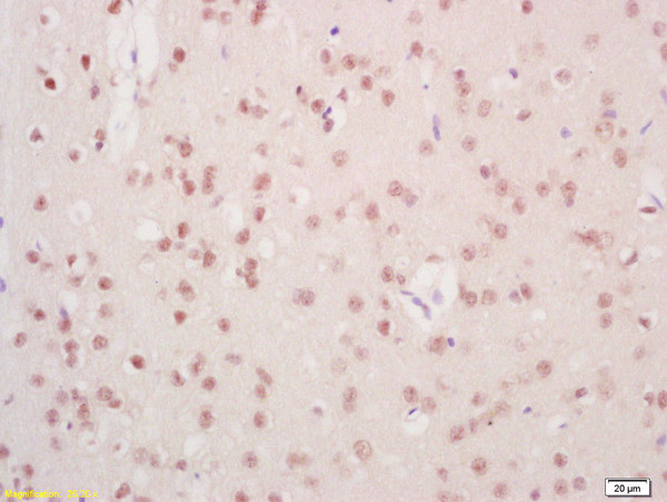 Mre11 Antibody in Immunohistochemistry (Paraffin) (IHC (P))