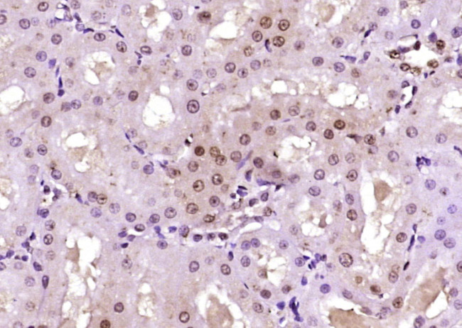 SCP3 Antibody in Immunohistochemistry (Paraffin) (IHC (P))