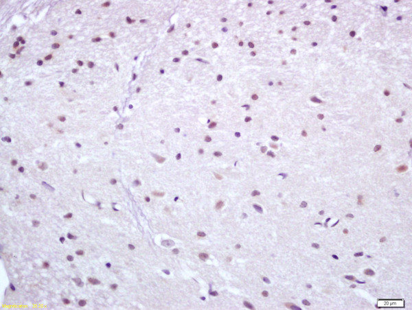 Nur77 Antibody in Immunohistochemistry (Paraffin) (IHC (P))