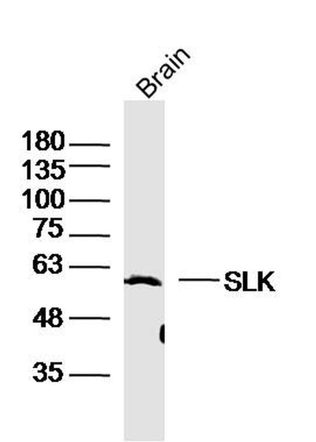 SLK Antibody in Western Blot (WB)