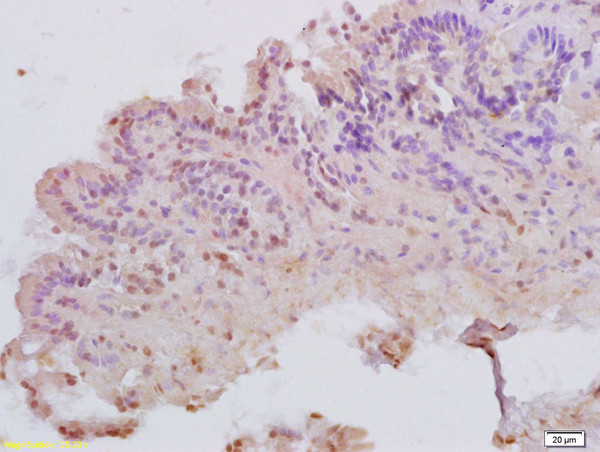 MATH1 Antibody in Immunohistochemistry (Paraffin) (IHC (P))