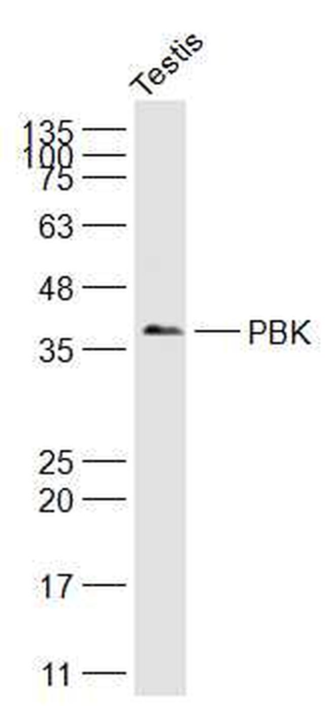 PBK Antibody in Western Blot (WB)