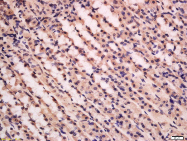 PFK2 Antibody in Immunohistochemistry (Paraffin) (IHC (P))