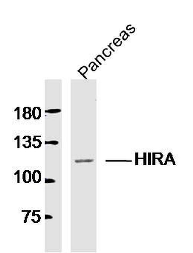 HIRA Antibody in Western Blot (WB)