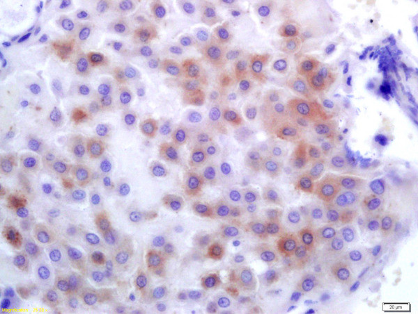 PLK1 Antibody in Immunohistochemistry (Paraffin) (IHC (P))