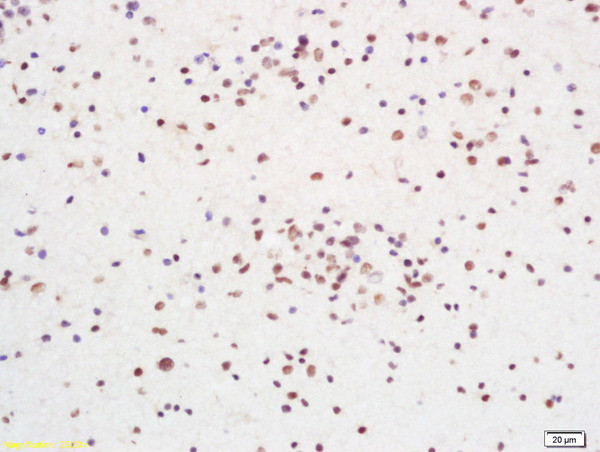 RCC1 Antibody in Immunohistochemistry (Paraffin) (IHC (P))