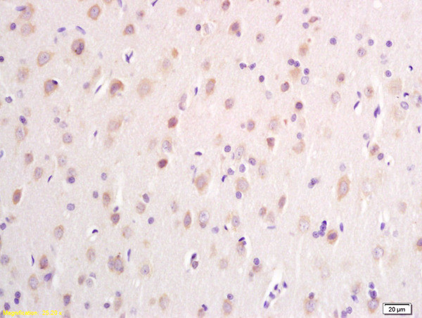 DTNB Antibody in Immunohistochemistry (Paraffin) (IHC (P))