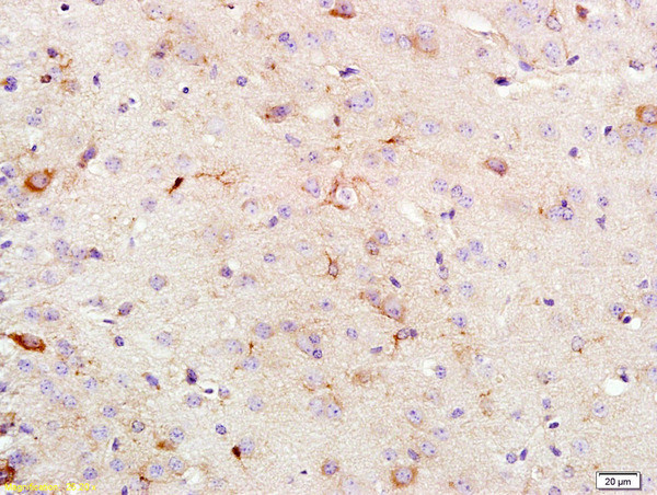 KSR1 Antibody in Immunohistochemistry (Paraffin) (IHC (P))