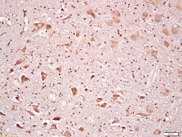 Rsk2 Antibody in Immunohistochemistry (Paraffin) (IHC (P))