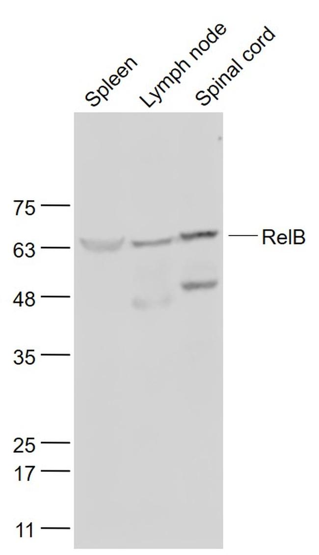 RelB Antibody in Western Blot (WB)