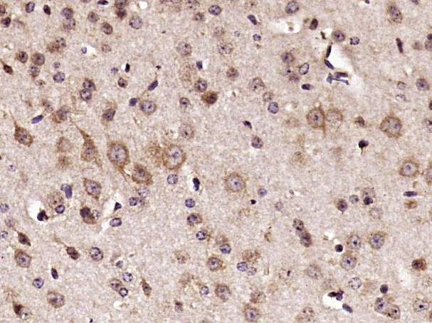 RPS6 Antibody in Immunohistochemistry (Paraffin) (IHC (P))
