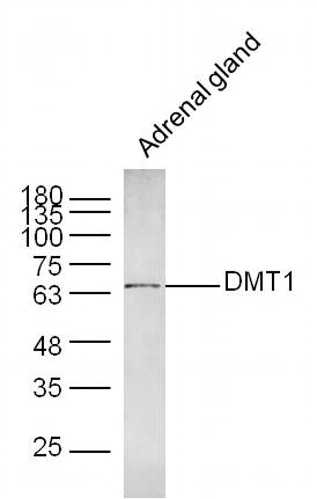 SLC11A2 Antibody in Western Blot (WB)