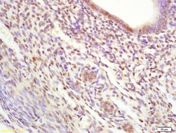 KAP1 Antibody in Immunohistochemistry (Paraffin) (IHC (P))