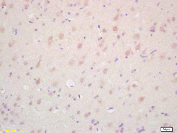 TAK1 Antibody in Immunohistochemistry (Paraffin) (IHC (P))