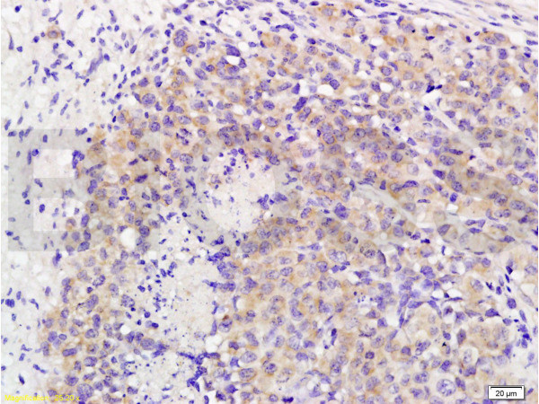 MAP3K8 Antibody in Immunohistochemistry (Paraffin) (IHC (P))