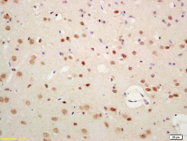 SIAH1 Antibody in Immunohistochemistry (Paraffin) (IHC (P))
