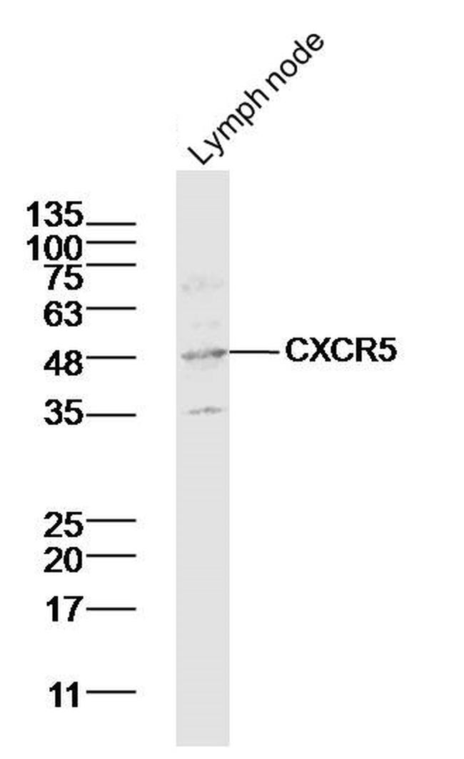 CXCR5/CD185 Antibody in Western Blot (WB)