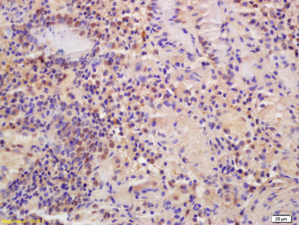 MTF-1 Antibody in Immunohistochemistry (Paraffin) (IHC (P))