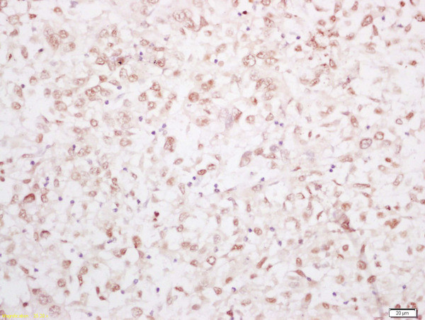 YAP1 Antibody in Immunohistochemistry (Paraffin) (IHC (P))