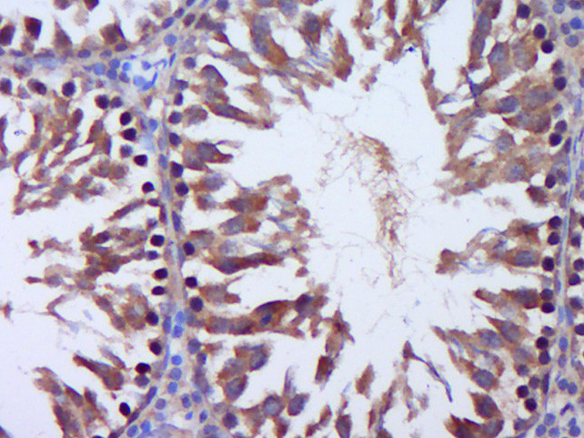Talin1 + 2 Antibody in Immunohistochemistry (Paraffin) (IHC (P))