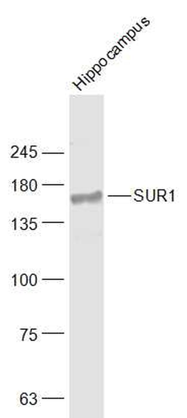 SUR1 Antibody in Western Blot (WB)