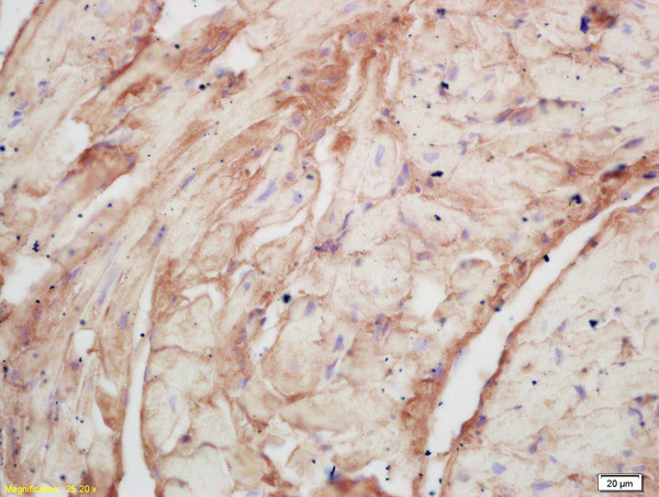 PLASTIN3/T Plastin Antibody in Immunohistochemistry (Paraffin) (IHC (P))