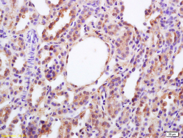 Bag1/RAP46 Antibody in Immunohistochemistry (Paraffin) (IHC (P))