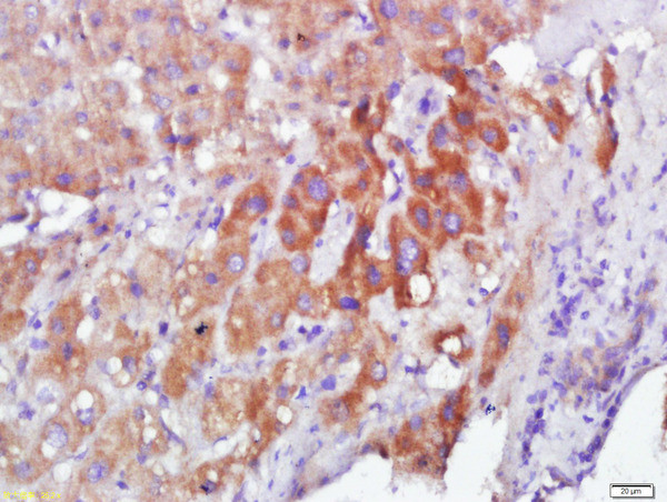 Calmodulin Antibody in Immunohistochemistry (Paraffin) (IHC (P))
