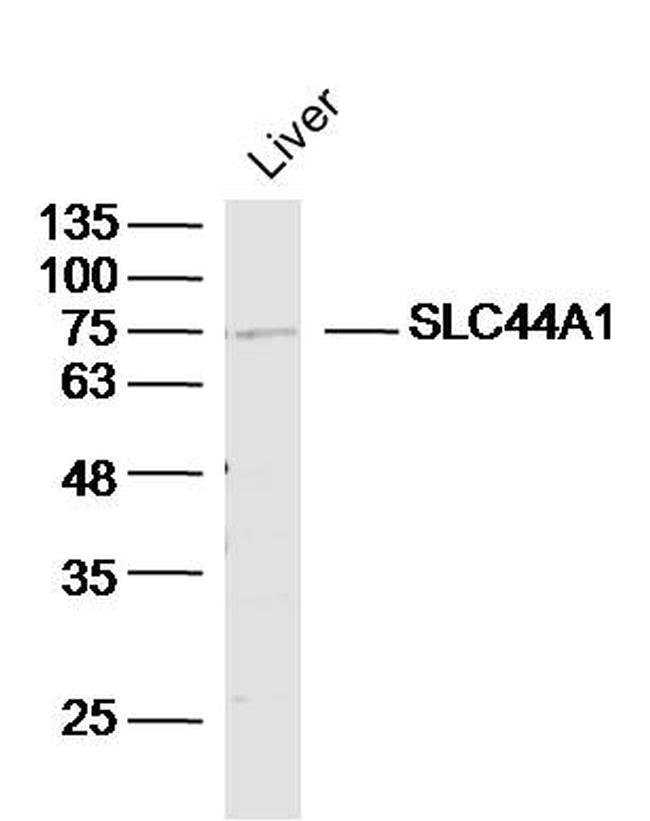 SLC44A1/CD92 Antibody in Western Blot (WB)