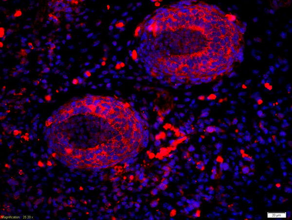 RALDH2 Antibody in Immunohistochemistry (Paraffin) (IHC (P))