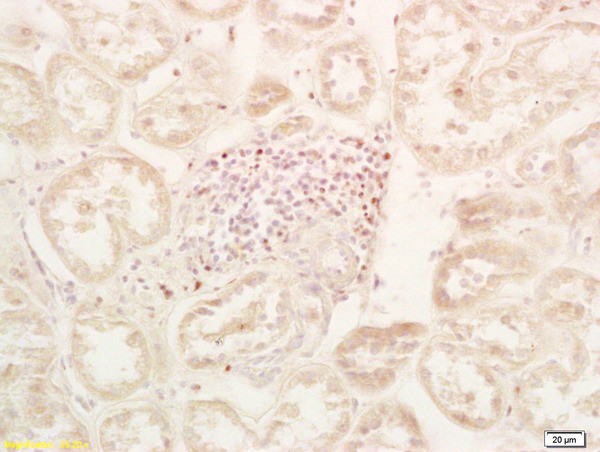 PHD2 Antibody in Immunohistochemistry (Paraffin) (IHC (P))