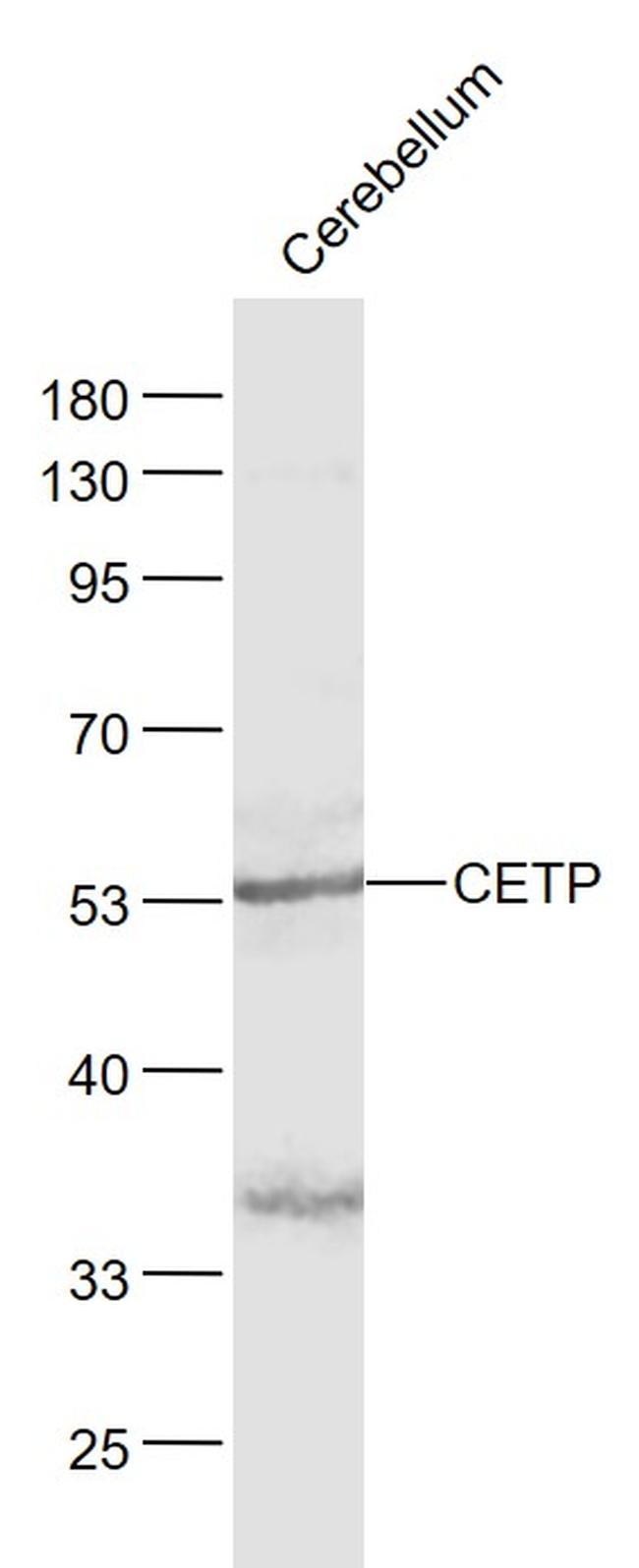 CETP Antibody in Western Blot (WB)