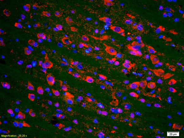 Phospho-P53 (Ser20) Antibody in Immunohistochemistry (Paraffin) (IHC (P))