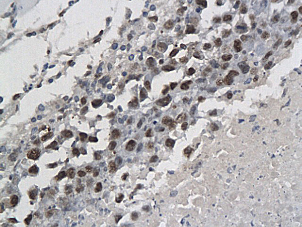 Phospho-P53 (Ser315) Antibody in Immunohistochemistry (Paraffin) (IHC (P))