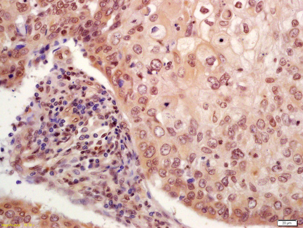 Phospho-P53 (Ser33) Antibody in Immunohistochemistry (Paraffin) (IHC (P))
