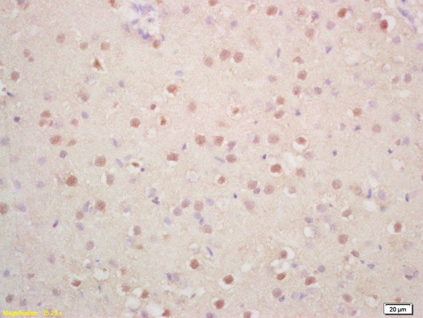 Phospho-p57 Kip2 (Thr310) Antibody in Immunohistochemistry (Paraffin) (IHC (P))
