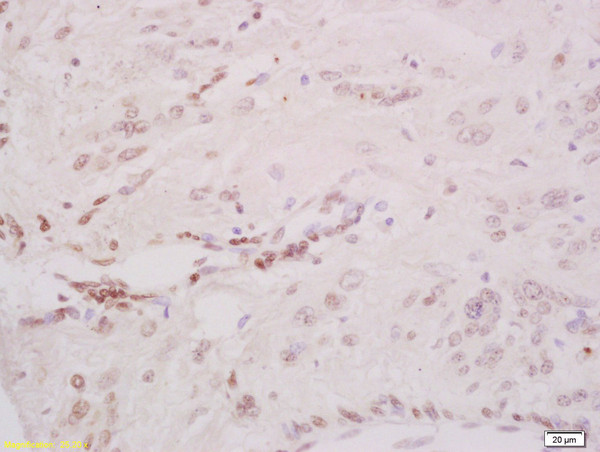 Phospho-CHK2 (Thr68) Antibody in Immunohistochemistry (Paraffin) (IHC (P))