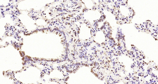 Phospho-PKC delta (Thr505, Thr507) Antibody in Immunohistochemistry (Paraffin) (IHC (P))