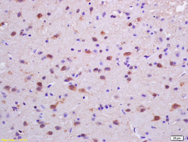 Phospho-PKC delta (Tyr313) Antibody in Immunohistochemistry (Paraffin) (IHC (P))