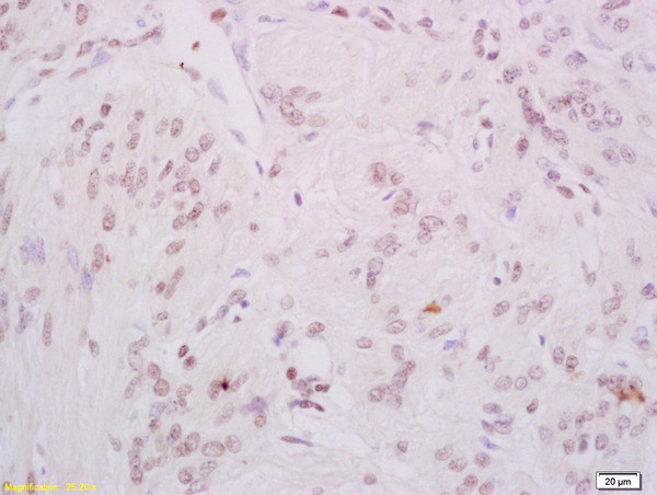 Phospho-DNA PK/PRKDC (Ser2056) Antibody in Immunohistochemistry (Paraffin) (IHC (P))