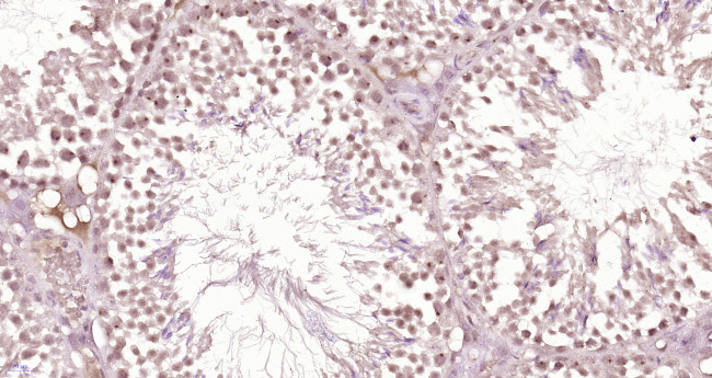 Phospho-DNA PK/PRKDC (Thr2609) Antibody in Immunohistochemistry (Paraffin) (IHC (P))