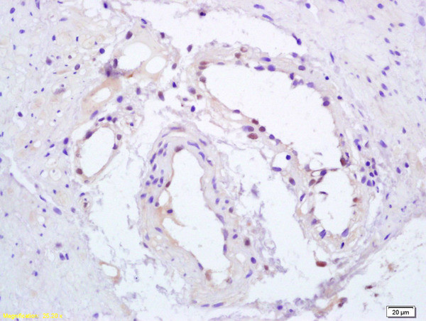 Phospho-PPAR Gamma (Ser112) Antibody in Immunohistochemistry (Paraffin) (IHC (P))