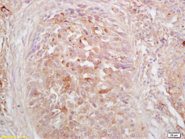 Phospho-HSF1 (Ser326) Antibody in Immunohistochemistry (Paraffin) (IHC (P))