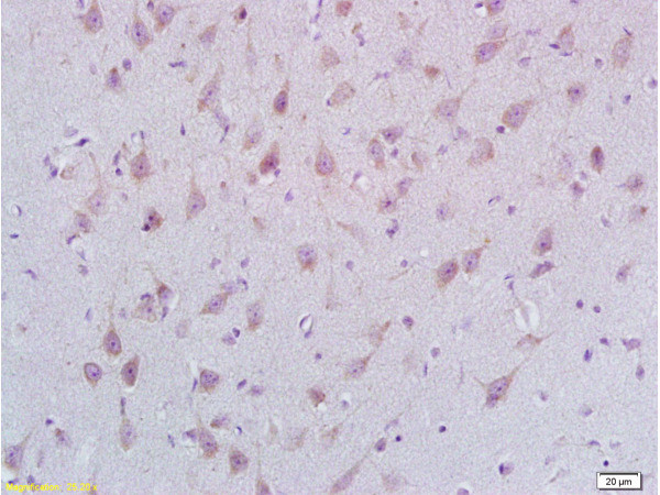 STMN2/SCG10 Antibody in Immunohistochemistry (Paraffin) (IHC (P))
